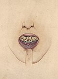 Thumbnail for version as of 20:59, 5 November 2024